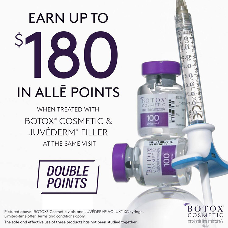 Alle Double Points Special